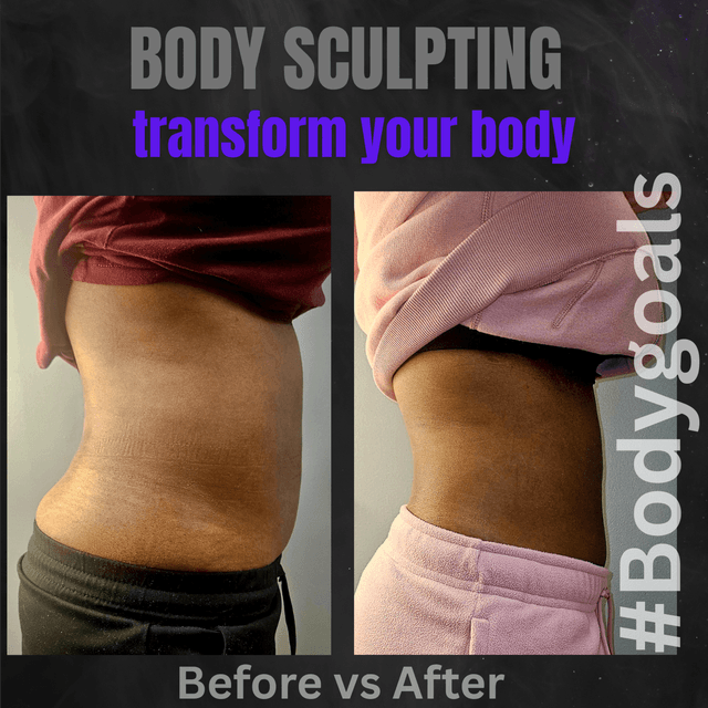 Body Sculpting Package at Nude Euphoriq in Rochester, NY